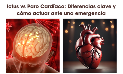 Ictus vs Paro Cardíaco: Diferencias clave y cómo actuar ante una emergencia5 (3)